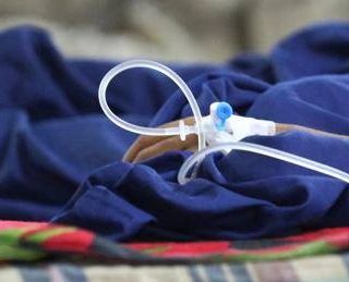 Fine vita, primo caso di suicidio assistito in Lombardia