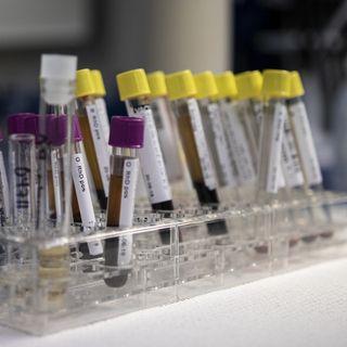 Giornata di prevenzione e screening gratuito contro l’epatite C a Pinerolo, Rivoli e Susa