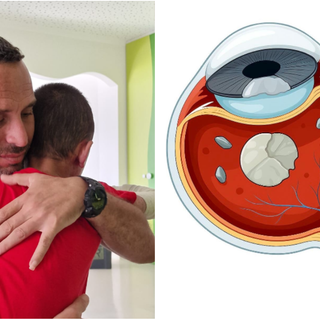 Perde la vista per l’esplosione di una bomba a Gaza: Assad, 8 anni, torna a vedere dopo l’intervento a Torino