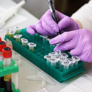 Coronavirus, altri 69 decessi in Piemonte. Più di 700 i nuovi positivi