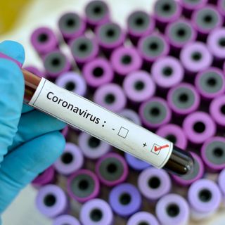 Coronavirus, altri 31 decessi in Piemonte. Ma sono 327 le persone guarite nelle ultime 24 ore