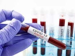 Coronavirus, in Piemonte numeri da zona rossa: nelle ultime 24 ore 2.086 nuovi casi, +16 terapie intensive e 100 altri ricoverati