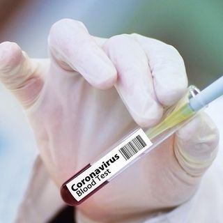 Pfizer e l'annuncio atteso da tutto il mondo: &quot;Il nostro vaccino contro il Coronavirus efficace al 90%. Prime dosi entro l'anno&quot;