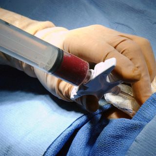 Intervento chirurgico alle Molinette