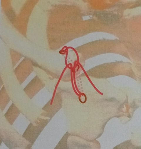 Esami medici di una clavicola Esami medici di una clavicola