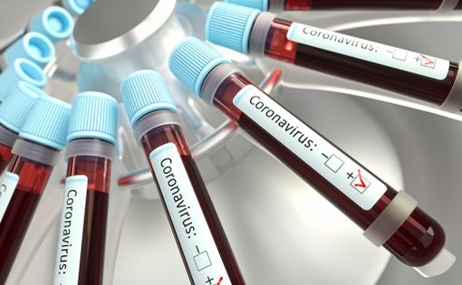 il coronavirus continua a mietere vittime