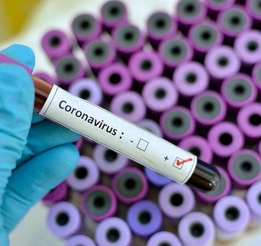 Coronavirus, 4 decessi in Piemonte. Supera quota 25 mila il totale tra pazienti guariti e in via di guarigione