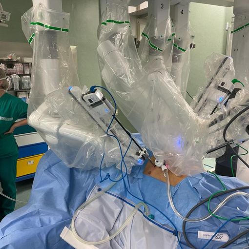 Molinette, salvata una donna con un raro tumore sul torace: per la prima volta il robot ha praticato un'unica piccola incisione