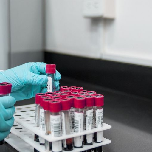 Coronavirus, il test sierologico mostra un Piemonte con solo il 5,5% di positivi. &quot;Abbiamo contenuto la pandemia&quot;