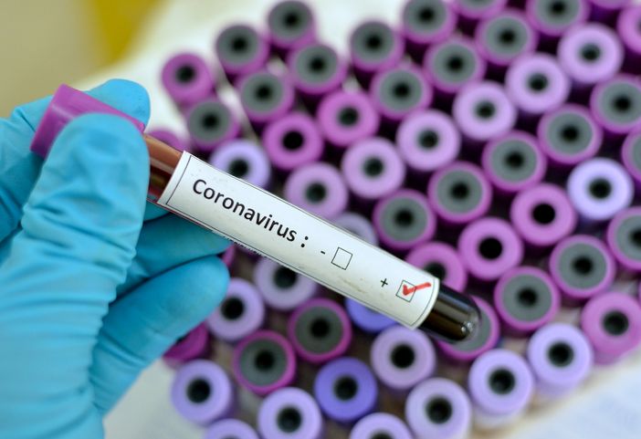 Effetto Coronavirus sull'economia piemontese: l'artigianato parte bene, ma teme contraccolpi. E anche Confindustria trema
