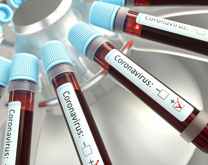 Quasi 100 morti per il coronavirus in Piemonte, ma continuano a calare terapie intensive e ricoveri