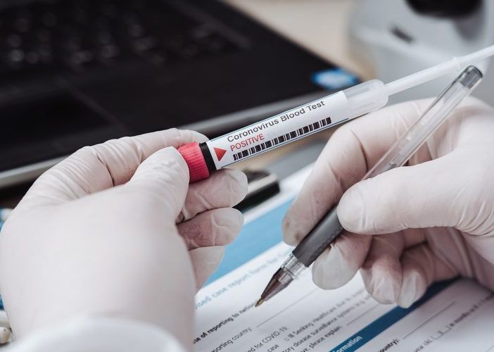 Coronavirus, altri 32 morti in Piemonte. Ma il totale dei guariti sfiora quota 10 mila