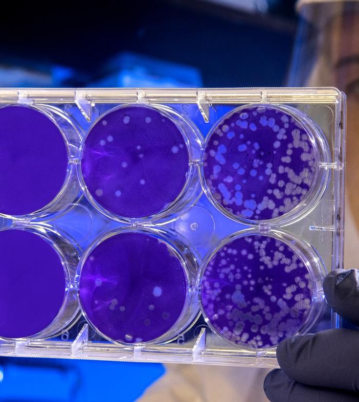 “In settimana le linee guida per i test sierologici in Piemonte”