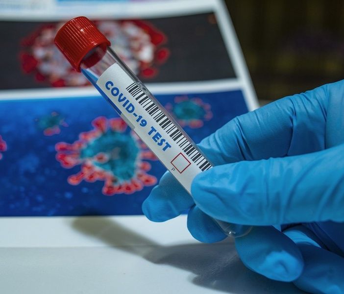 Coronavirus, soltanto 5 persone ancora in terapia intensiva in tutto il Piemonte, nessun decesso