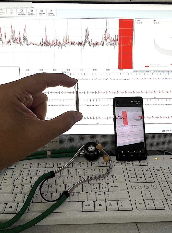 Strumentazione medica davanti a un monitor