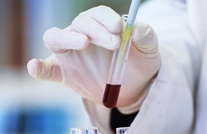 I ricercatori di Unito sviluppano nuova terapia contro il tumore al pancreas