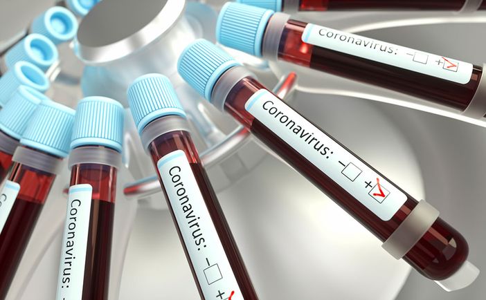 il coronavirus continua a mietere vittime