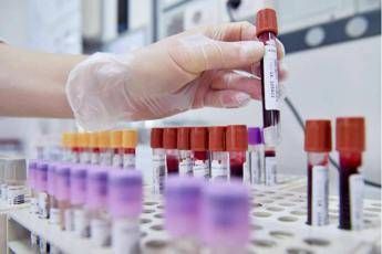 Sibioc, su ipotesi Regione Lazio: "No esternalizzazione medicina di laboratorio" Sibioc, su ipotesi Regione Lazio: "No esternalizzazione medicina di laboratorio"