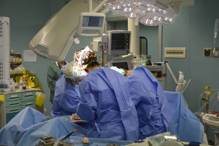 L'aritmia cardiaca altera il flusso cerebrale e provoca demenza e declino cognitivo