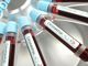 coronavirus - foto di repertorio