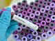 Coronavirus, altri 31 decessi in Piemonte. Ma sono 327 le persone guarite nelle ultime 24 ore