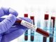 Coronavirus, in Piemonte numeri da zona rossa: nelle ultime 24 ore 2.086 nuovi casi, +16 terapie intensive e 100 altri ricoverati