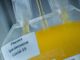 Coronavirus, all’Asl To3 al via la raccolta plasma per la cura sperimentale: si parte dal Centro Trasfusionale di Pinerolo