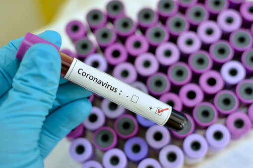 Coronavirus, 1 persona deceduta e 6 nuovi casi positvi in Piemonte. Calano ancora i ricoverati in ospedale