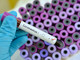 Coronavirus, 17 i decessi comunicati oggi in Piemonte. Altri 370 pazienti guariti