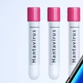 Hantavirus non può causare pandemia ma epidemie gravi sì: lo studio su focolaio Mv Hondius Hantavirus non può causare pandemia ma epidemie gravi sì: lo studio su focolaio Mv Hondius