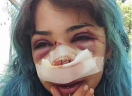Bari, studentessa picchiata nei bagni denuncia nuovo episodio: "Mi hanno accerchiata"