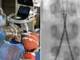 Incidente con un'acquasantiera in chiesa, bimba di 6 anni operata d'urgenza all'aorta a Bari