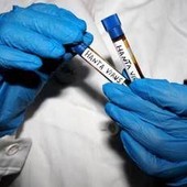 Hantavirus, Ema monitora diffusione: "Pronti a supportare iter vaccini"