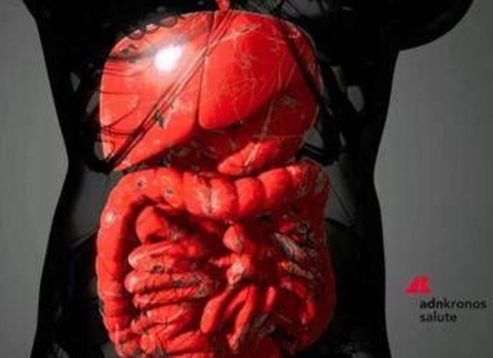 Malattie infiammatorie intestinali, rimborsabile guselkumab per colite ulcerosa e Crohn Malattie infiammatorie intestinali, rimborsabile guselkumab per colite ulcerosa e Crohn