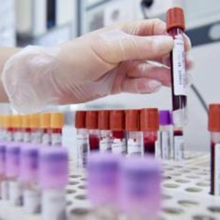 Dal microbiota una speranza contro l'epilessia resistente, lo studio italiano