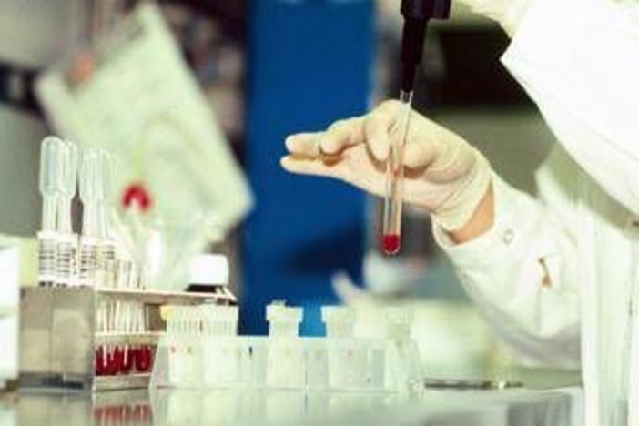 Antrace, vaiolo e virus 'zombie': l'indagine sui rischi nascosti nel ghiaccio da migliaia di anni Antrace, vaiolo e virus 'zombie': l'indagine sui rischi nascosti nel ghiaccio da migliaia di anni