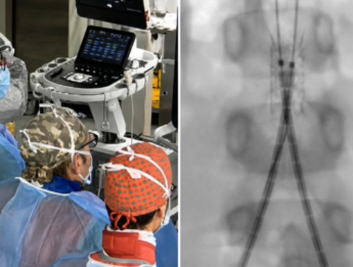 Incidente con un'acquasantiera in chiesa, bimba di 6 anni operata d'urgenza all'aorta a Bari