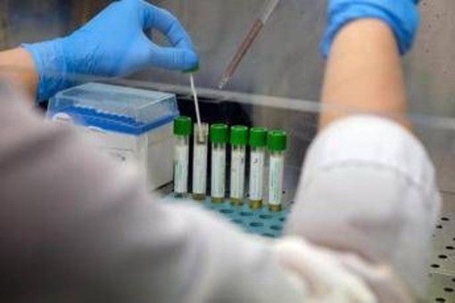 Medicina, italiani svelano errori nascosti nelle cellule: "Possibile ruolo in più malattie" Medicina, italiani svelano errori nascosti nelle cellule: "Possibile ruolo in più malattie"