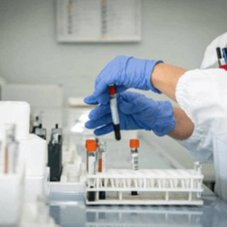 Hantavirus, 4 persone monitorate in Italia: "Non hanno sintomi"