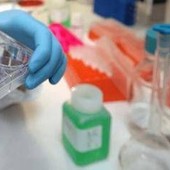 Tumori, in Europa mortalità maschile in calo del 7,8%: in Italia 15 mesi per le nuove terapie Tumori, in Europa mortalità maschile in calo del 7,8%: in Italia 15 mesi per le nuove terapie