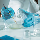 Linfoma mantellare, 'con trattamento chemio-free in prima linea -43% rischio di progressione o morte'