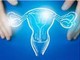 Tumori dell'endometrio, Picardo (Acto Piemonte): "Con dostarlimab trattamenti più efficaci per più donne"