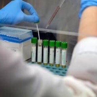 Medicina, italiani svelano errori nascosti nelle cellule: "Possibile ruolo in più malattie" Medicina, italiani svelano errori nascosti nelle cellule: "Possibile ruolo in più malattie"