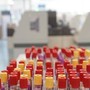 Cos'è il batterio mangiacarne sotto la lente a Messina, minaccia in crescita per il caldo record