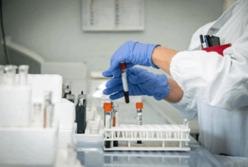 Alzheimer, test del sangue possono prevedere l'inizio dei sintomi Alzheimer, test del sangue possono prevedere l'inizio dei sintomi