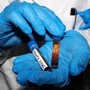Hantavirus, test negativo per la persona in isolamento in Veneto