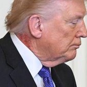 Trump e il collo arrossato, la foto riaccende i dubbi sulla salute del presidente Trump e il collo arrossato, la foto riaccende i dubbi sulla salute del presidente