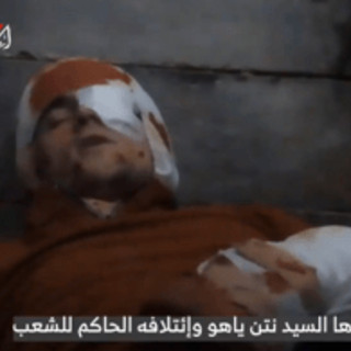 Hamas diffonde video dell'ostaggio Maxim Herkin ferito: &quot;Colpito dalle Idf in un tunnel&quot;