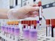 Hiv, dalla Sicilia il modello per estendere terapie long acting Hiv, dalla Sicilia il modello per estendere terapie long acting