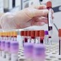 Tumori, cancro vescica: 70% pazienti libero da malattia a 2 anni con terapie perioperatorie